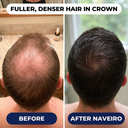 NAVEIRO Hair Growth Brush Serum for Men